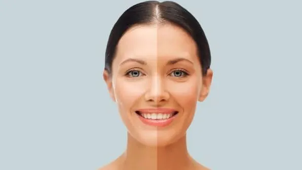 Skin Whitening Facial